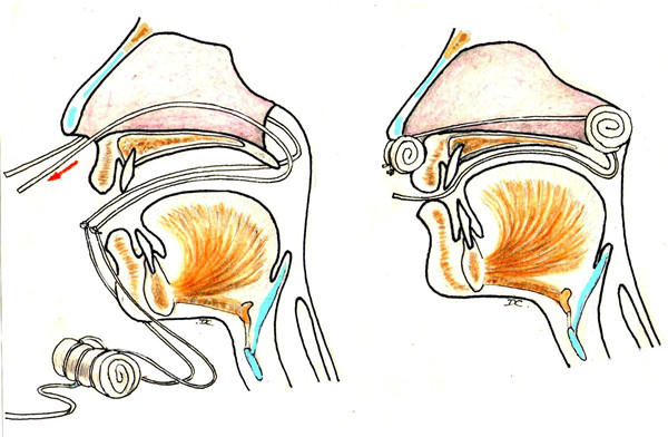 答图5-8纵膈分部2气体经鼻孔,鼻腔,鼻后孔,鼻咽,口咽,喉咽,喉口,喉