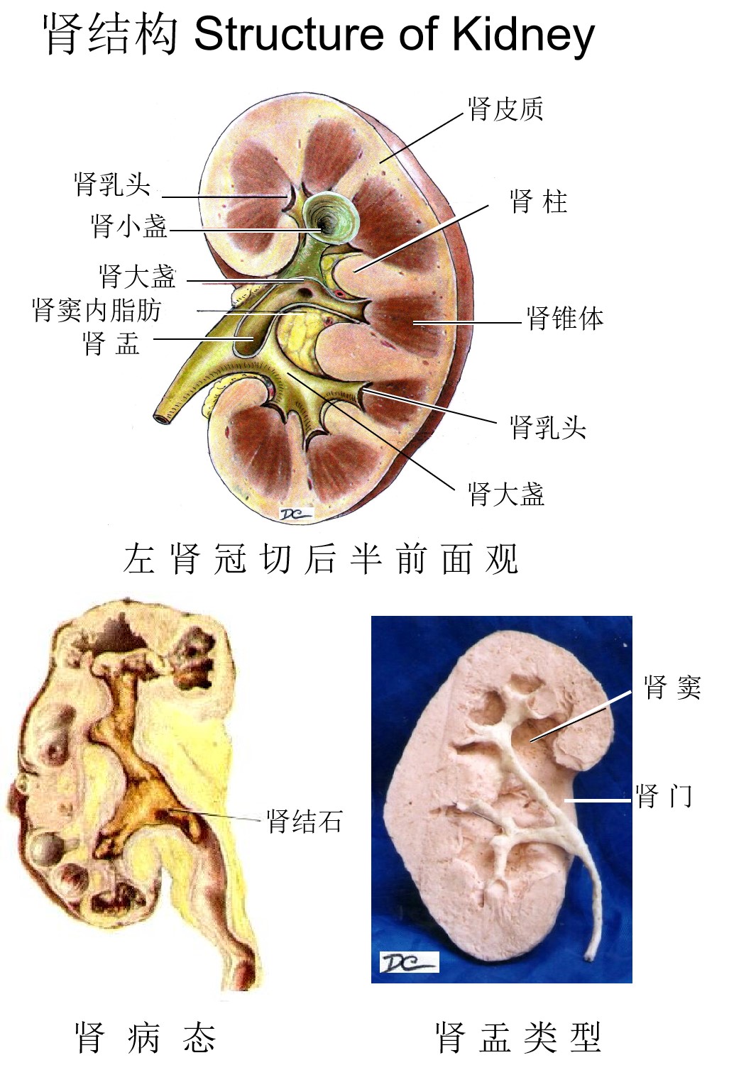 人体肾脏结构-下图为人体肾脏的内部结构示意图，据图回答问题。