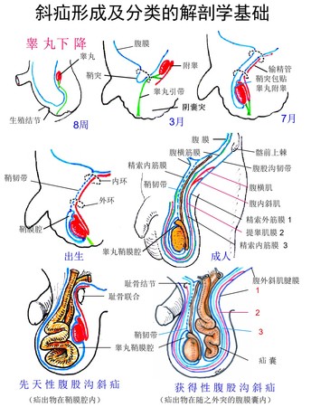 3睾丸下降.jpg