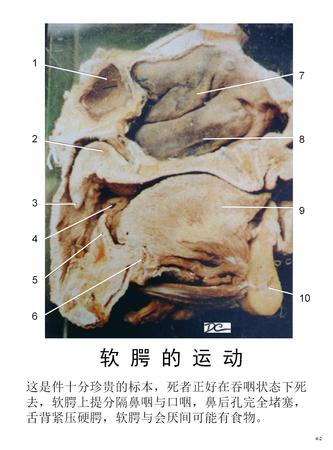 13软腭.jpg