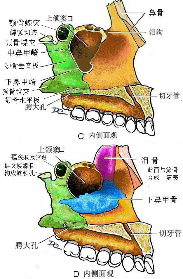 乙状窦骨壁缺损图片