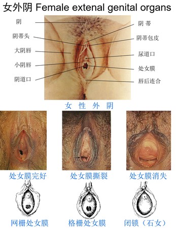 4女外阴.jpg