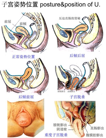 3子宫姿势和位置.jpg