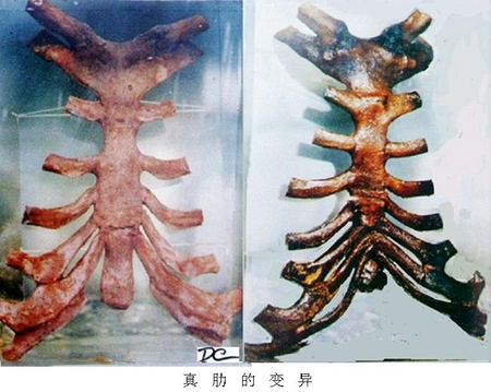 3真肋的变异.jpg