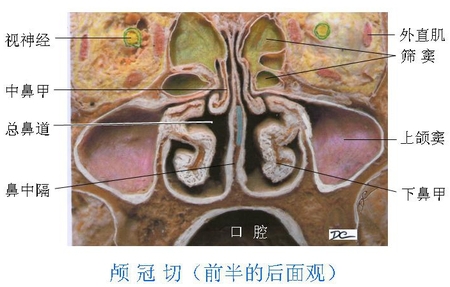 21鼻旁窦.jpg