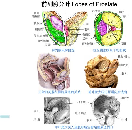 5前列腺分叶.jpg
