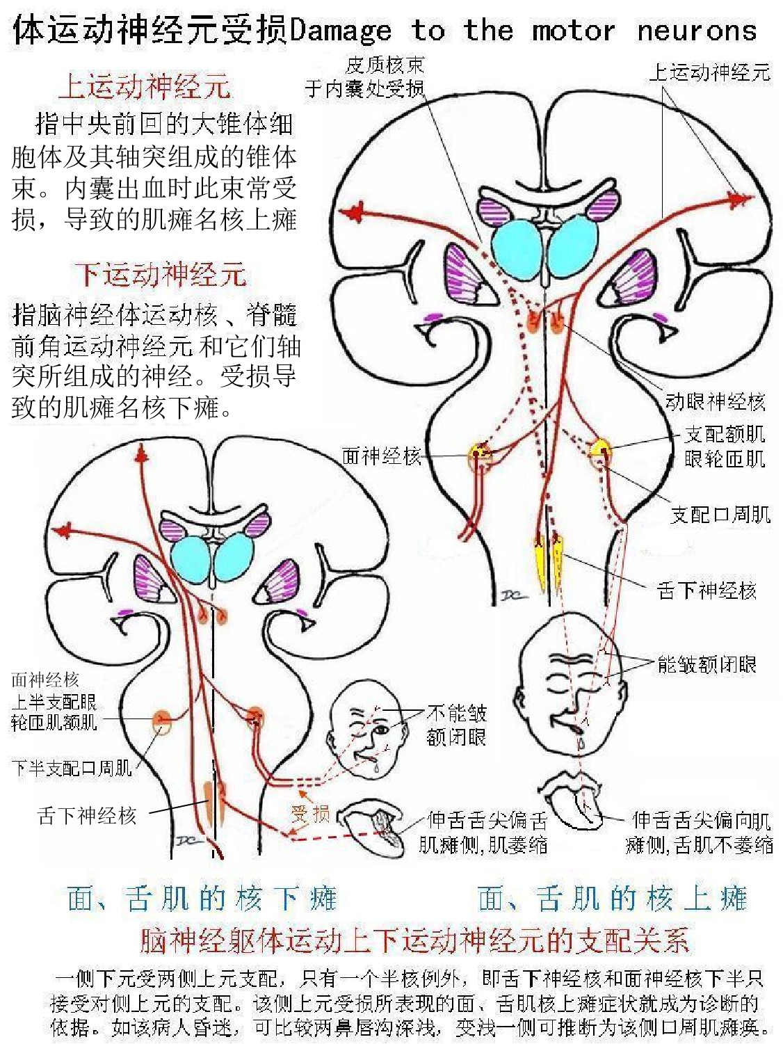 5体运动神经元受损 - 广州市苏密顿教具有限公司