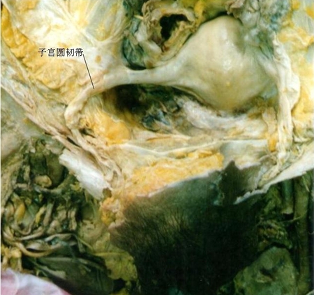 33子宫圆韧带.jpg