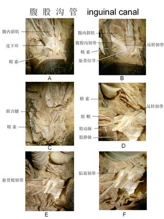 38腹股沟管.jpg